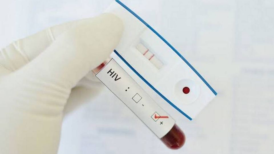 Este 1 de septiembre habrá pruebas de VIH en Miguel Hidalgo. FOTO: Freepik