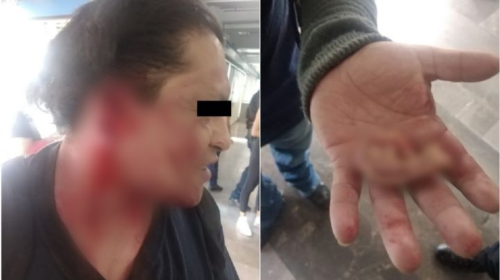 [FOTOS] Arrancan oreja a presunto acosador en Metro Xola